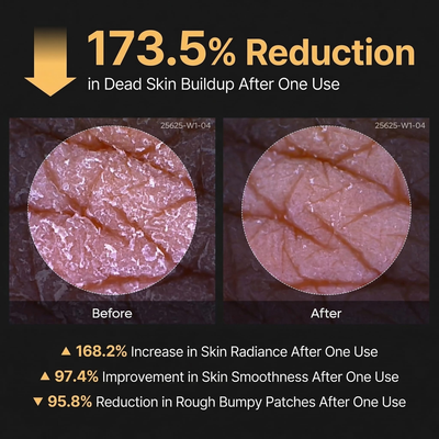 Turmeric Kojic Acid Exfoliating Spray