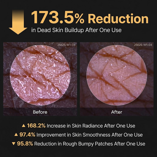 Turmeric Kojic Acid Exfoliating Spray